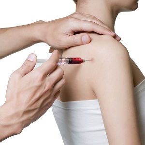 PRP Injections